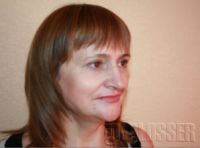 Подтяжка лица - до и после операции